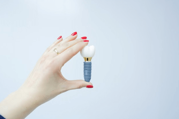 implante de dente mão