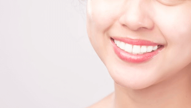 lente de contato para dentes sorriso