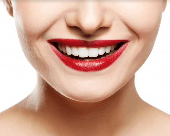 clareamento dental doi boca
