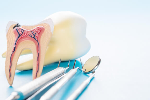 tratamento de canal dente