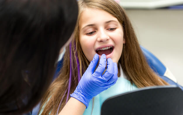 aparelho fixo criança