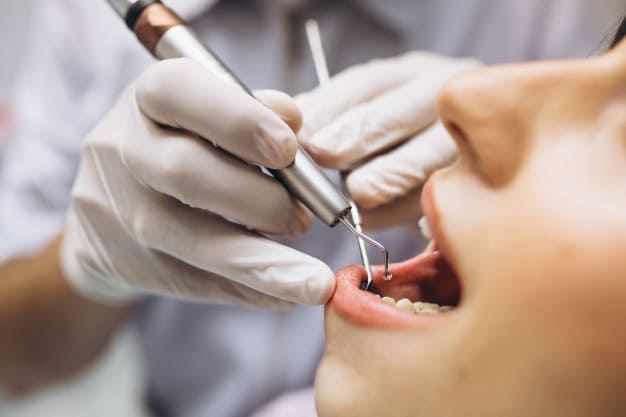 raiz do dente exposta paciente no dentista