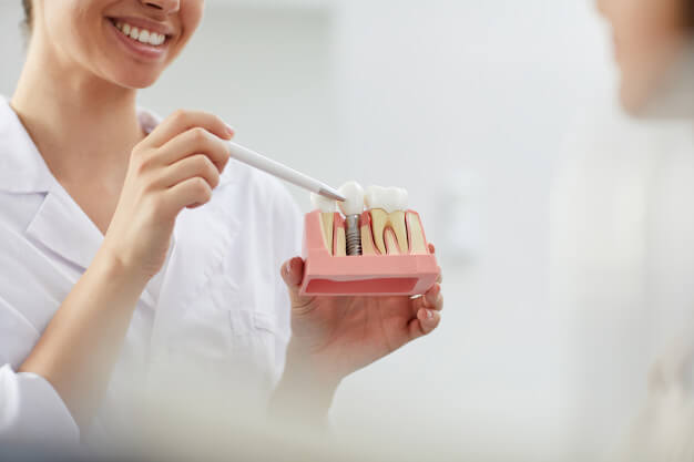 pos operatorio implante dentario dentista mostrando os cuidados