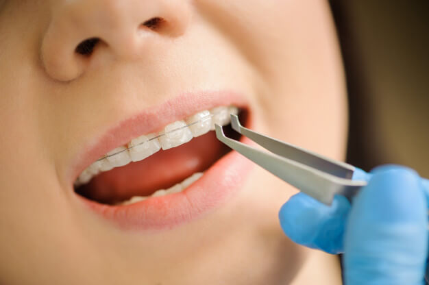 ortodontia dentista fazendo manutenção no aparelho da paciente