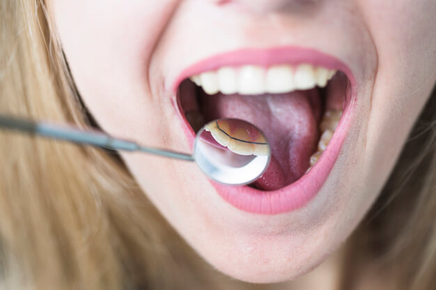 ortodontia paciente loira em atendimento odontologico