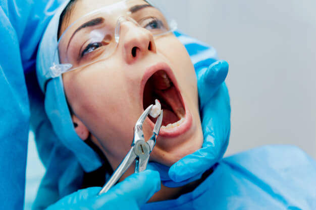 Siso Inflamado dentista extraindo o dente