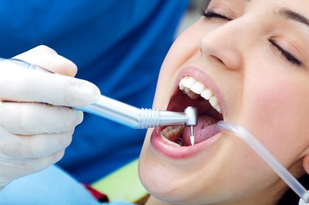 limpeza dentária dentista realizando limpeza dentaria em paciente